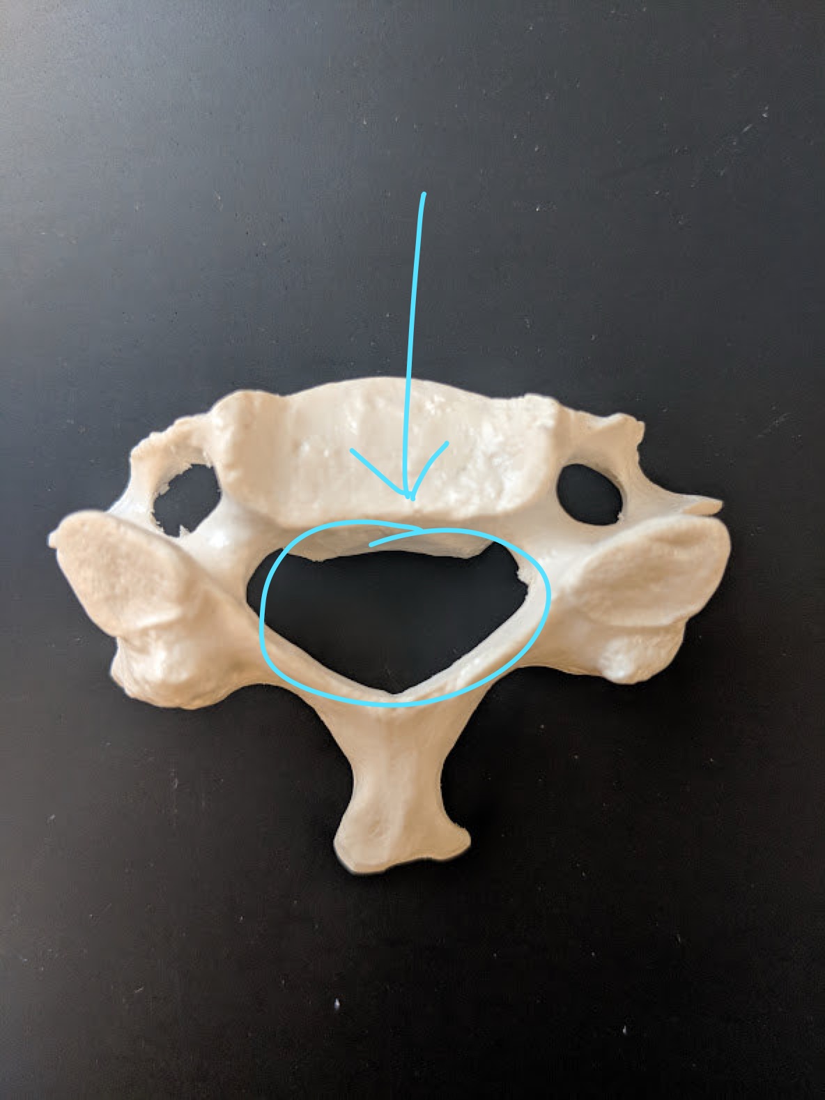 <p>Name this structure</p>