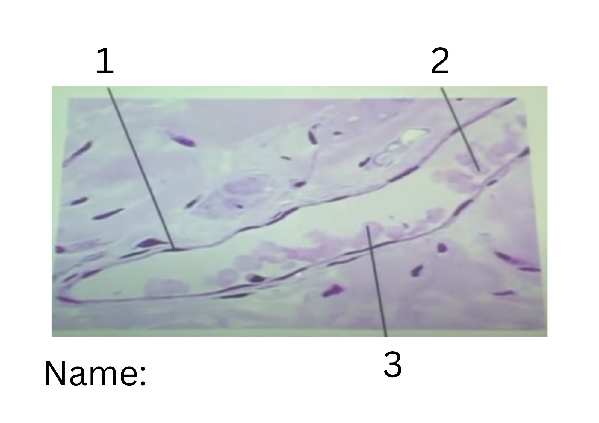 term image