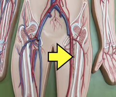 <p>Name the blood vessel.</p>