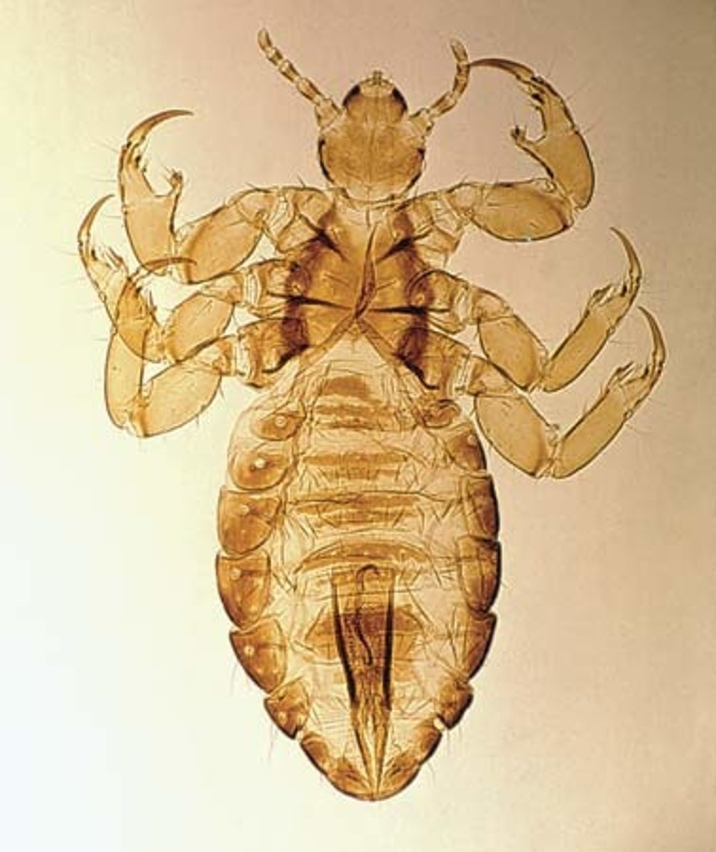 <p>feeds on: blood, human disease vectors</p><p>hosts: mammals</p><p>head is narrower than prothorax</p><p>Found on specific body parts of mammalian hosts:</p><p>i.crab louse-pubic</p><p>ii.head louse-hair on head</p><p>iii.body louse-specific body part</p>
