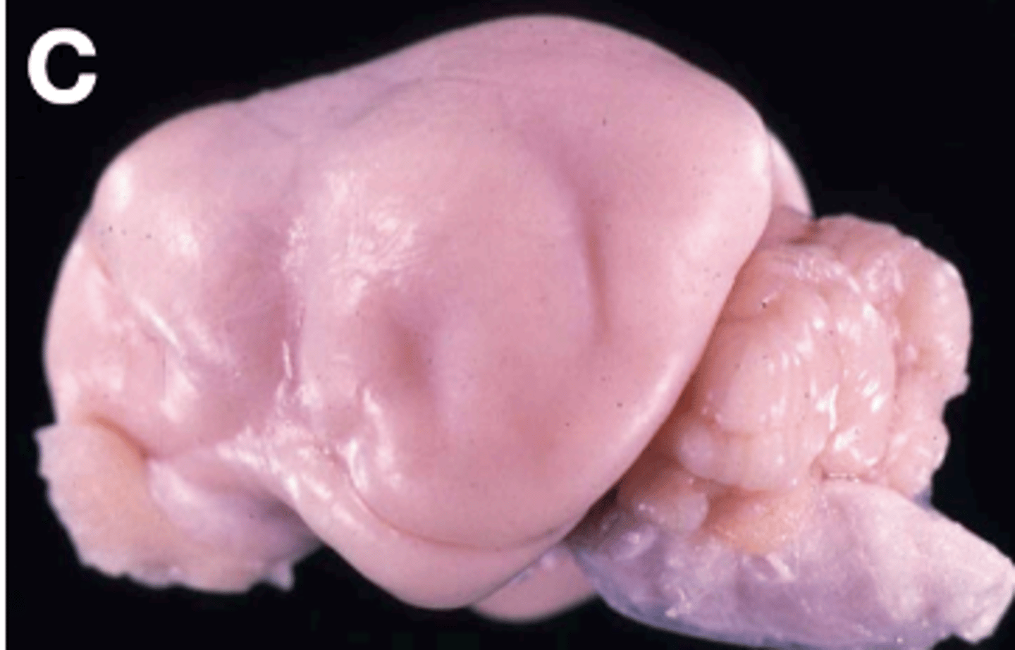 <p>- Smooth brain</p><p>- Normal in birds, rodents, and rabbits</p>