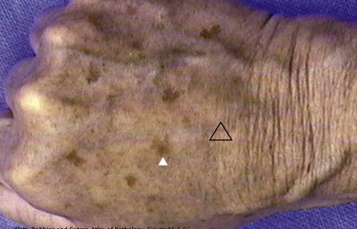 term image