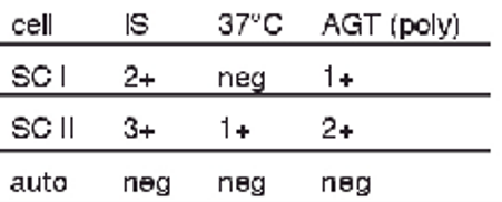 <p>antibody screen results + possible interpretations:</p><ul><li><p>2+ at IS w SCI</p></li><li><p>1+ at AHG w SCI</p></li><li><p>3+ at IS; 1+ at 37 C; 2+ at AHT w SCII</p></li></ul><p></p>