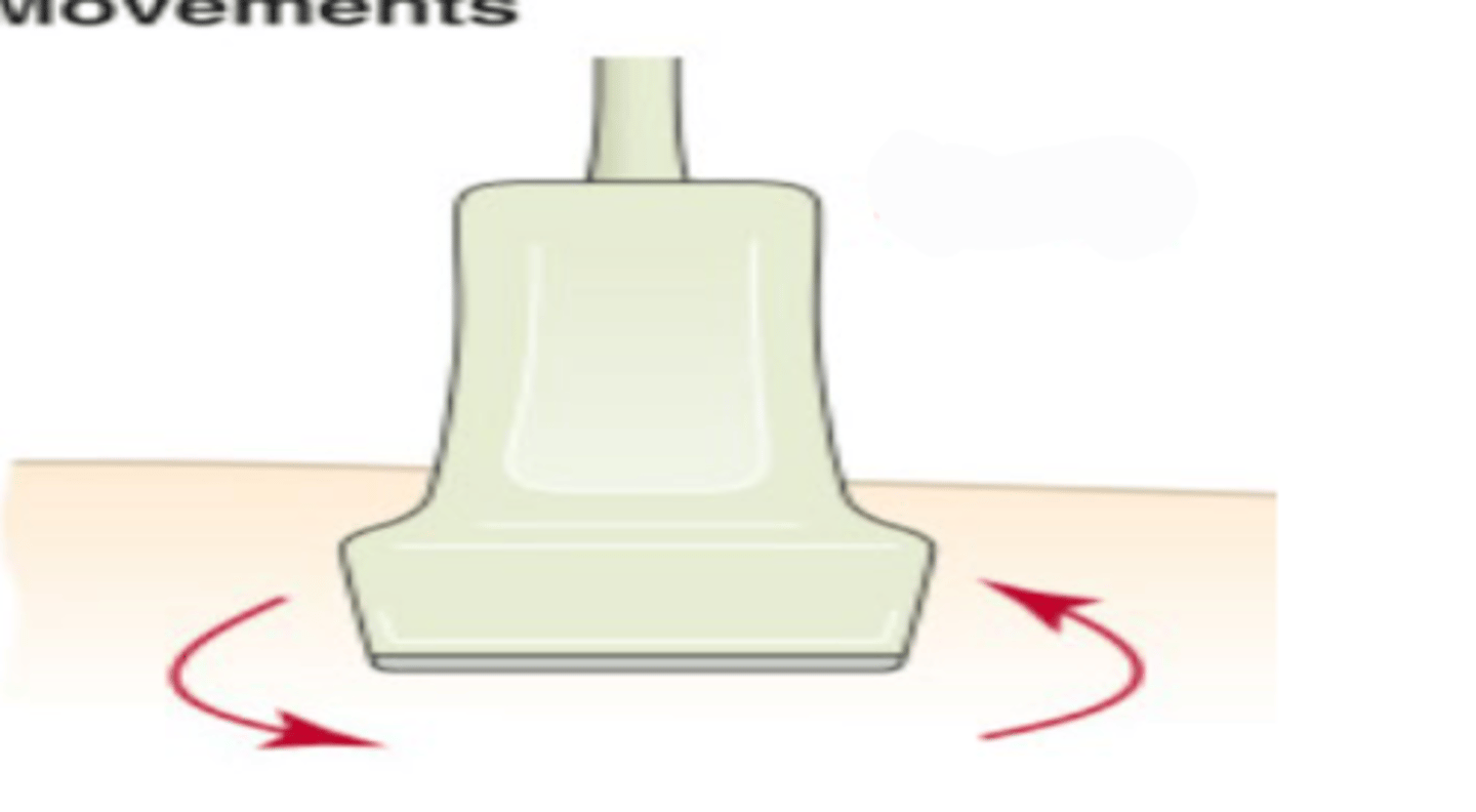 <p>what is this transducer movement called</p>