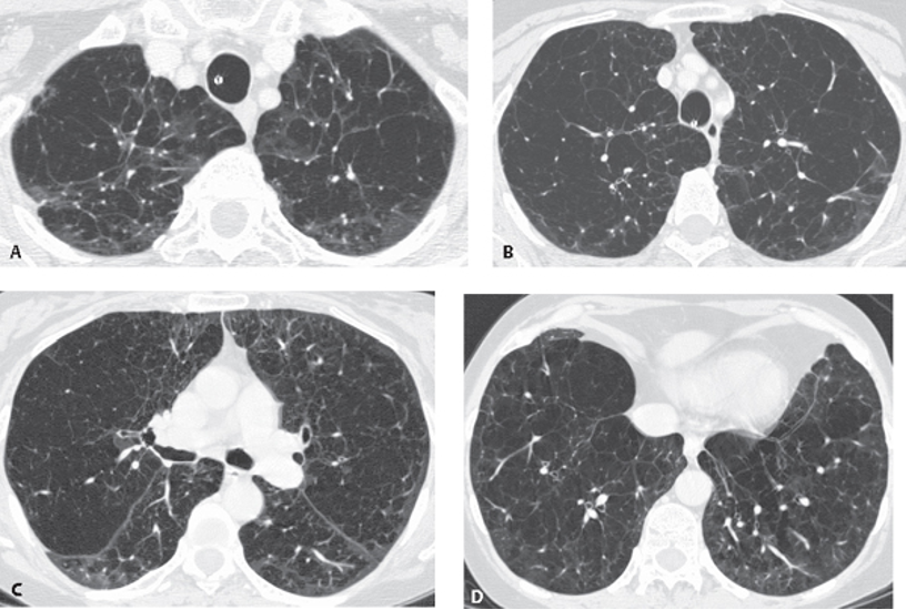 <p>What does this refer to </p>