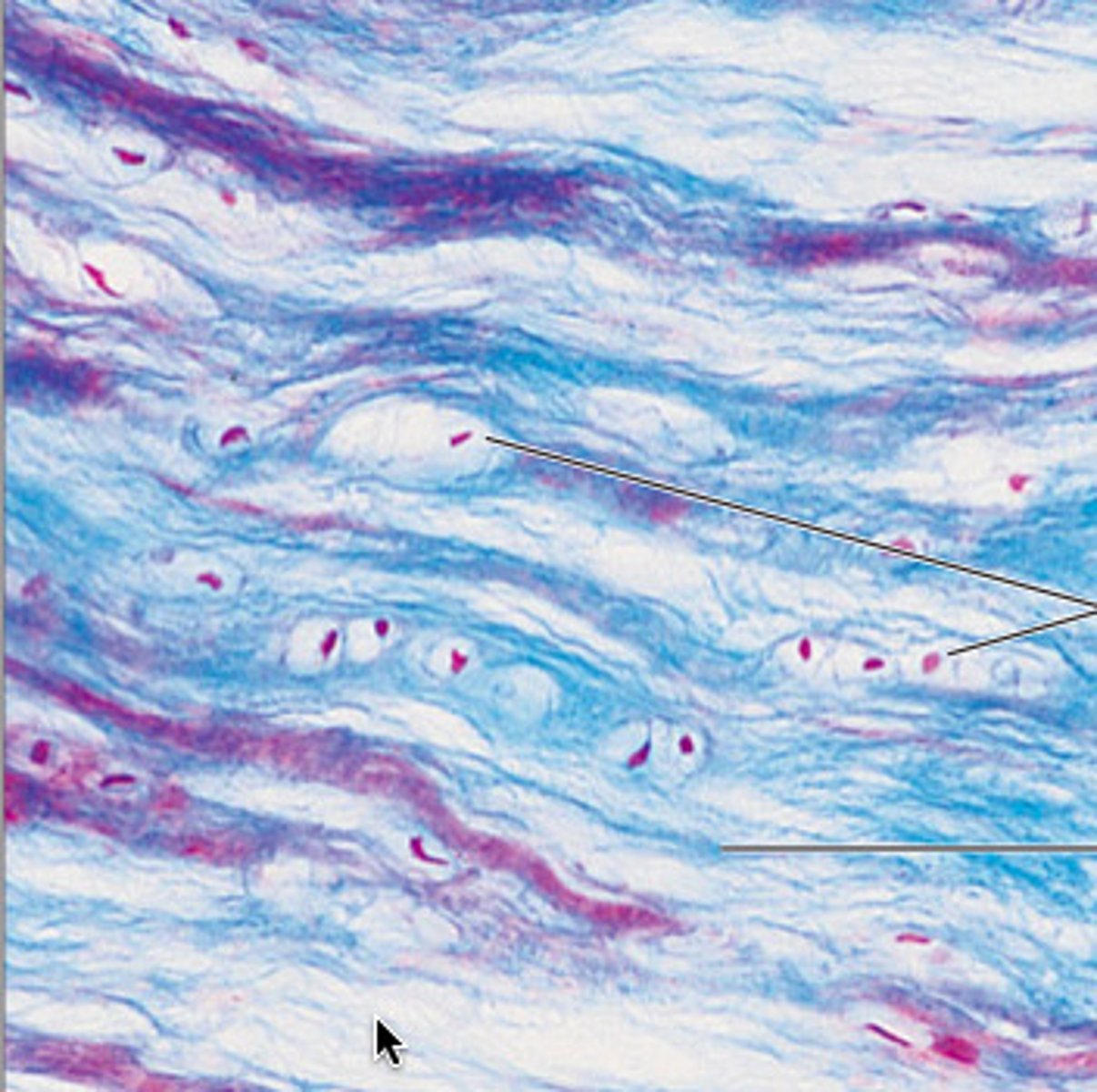 <p>Pads between vertebrae that are shock absorbers; make invertebral discs made of layers of collagen, compressible, contains fibrous bundles of collagen</p>