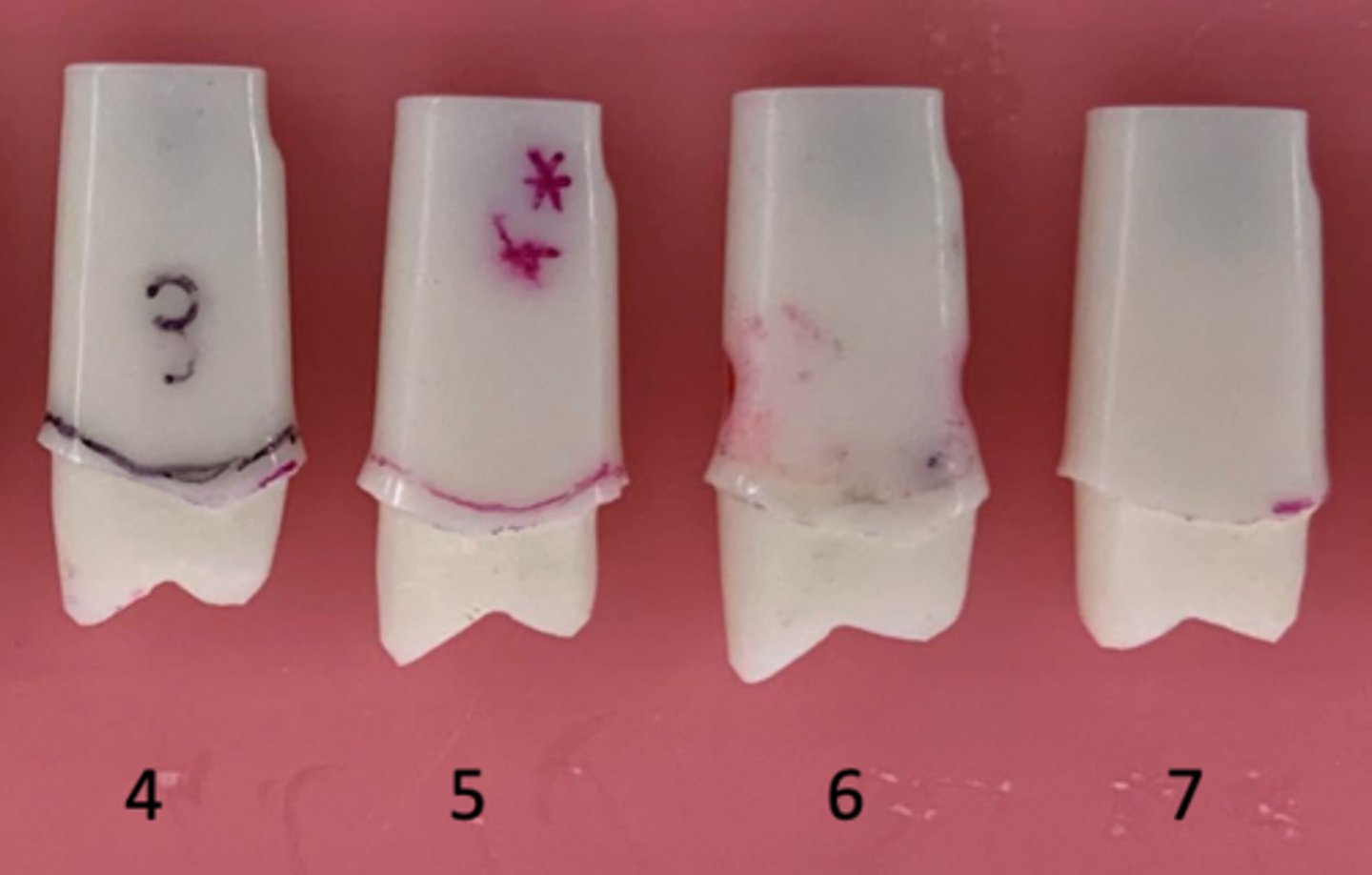 <p>Which tooth has an undercut?</p>