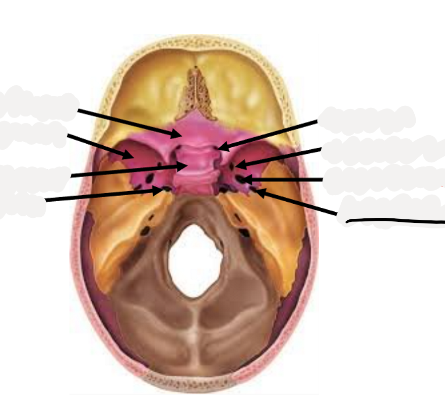<p>Middle meningeal artery</p>