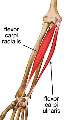 <p>origin: humerus</p><p>insertion: base of <strong>metacarpals II-III</strong></p><p>action: powerful flexor and abductor of the hand</p>