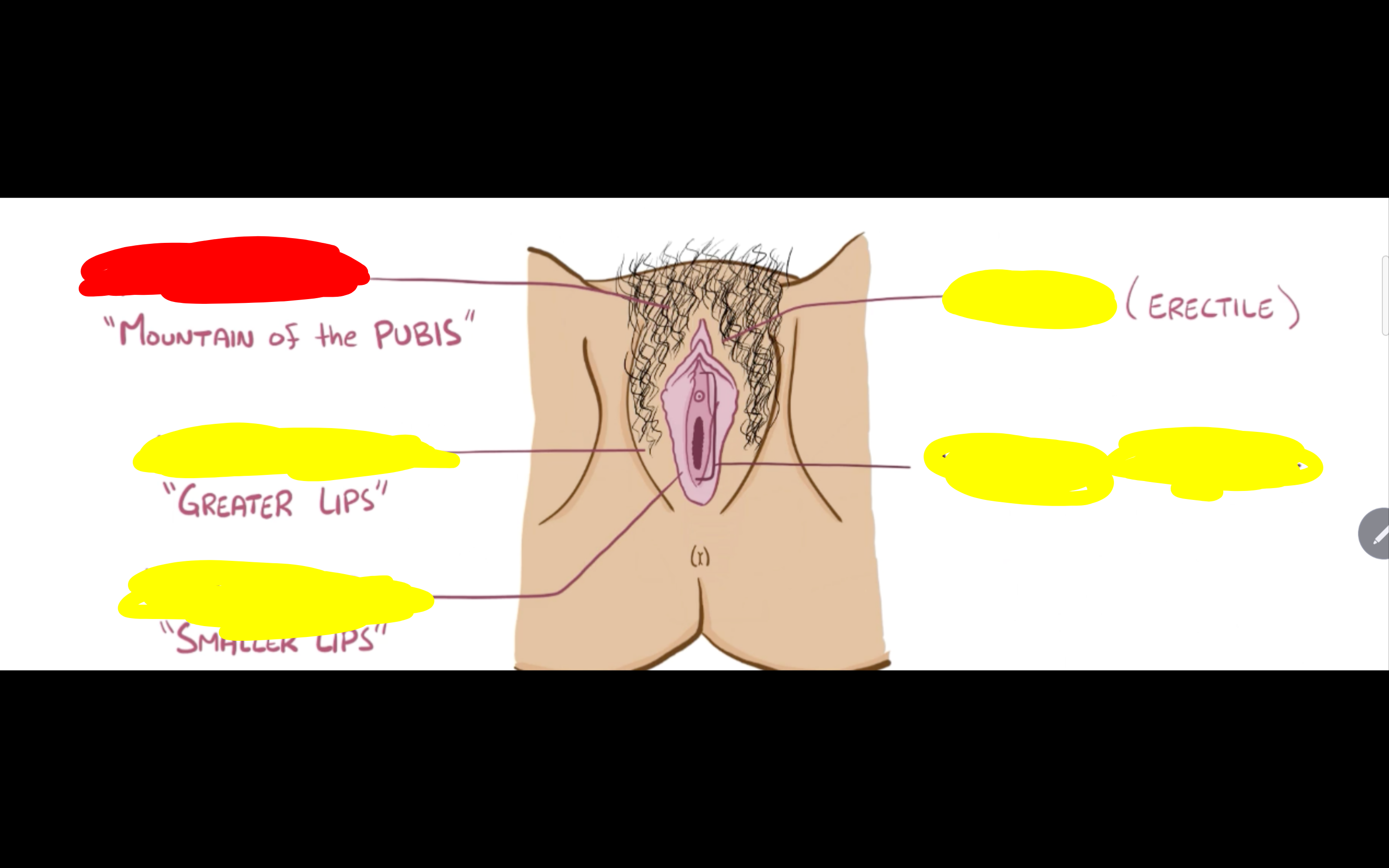 <p>Name the structure in red</p>