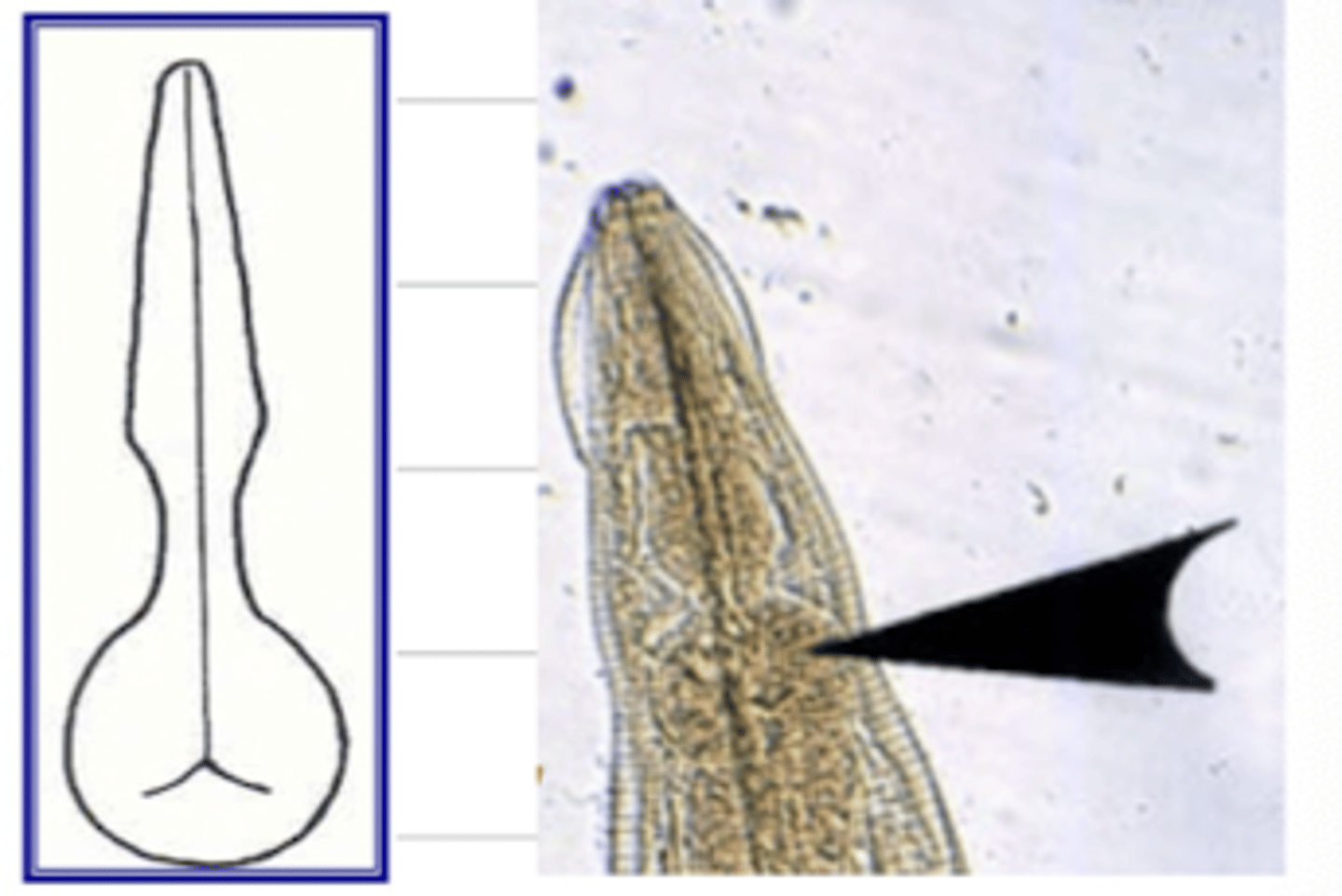 <p>parasites in the family Oxyuridae have a ________ esophagus</p>
