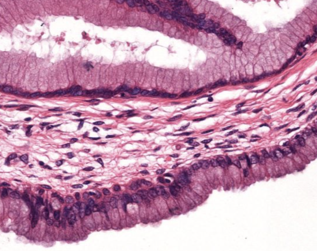 <p><strong><u>Epithelium:</u></strong> <span style="color: green;"><strong>Tall columnar</strong></span><strong> </strong>and has <span style="color: green;"><strong>goblet cells</strong></span><strong> </strong>that produce <span style="color: green;"><strong>mucus</strong></span></p><ul><li><p><strong><u>Function in gravid animals:</u> </strong><span style="color: green;"><strong>Mucus</strong></span><strong> </strong>becomes <span style="color: green;"><strong>very thick</strong></span><strong> </strong>and <span style="color: green;"><strong>accumulates</strong></span><strong> </strong>in <span style="color: green;"><strong>cervical canal</strong></span><strong> </strong>into a <span style="color: green;"><strong>cervical plus </strong></span></p><ul><li><p>Which <span style="color: green;"><strong>seals</strong></span><strong> </strong>the <span style="color: green;"><strong>cervix</strong></span><strong> </strong>and <span style="color: green;"><strong>protects</strong></span><strong> </strong>the <span style="color: green;"><strong>uterus</strong></span><strong> </strong>and <span style="color: green;"><strong>fetus</strong></span><strong> </strong>from <span style="color: green;"><strong>bacteria</strong></span> or <span style="color: green;"><strong>debris</strong></span></p></li></ul></li></ul><p><strong><u>Lack of:</u> </strong><span style="color: green;"><strong>Glands</strong></span></p><p><strong><u>Describe the connective tissue:</u> </strong><span style="color: green;"><strong>Dense</strong></span><strong> </strong>and <span style="color: green;"><strong>irregular</strong></span><strong> </strong>and forms<span style="color: green;"> <strong>major folds </strong></span></p><p></p>