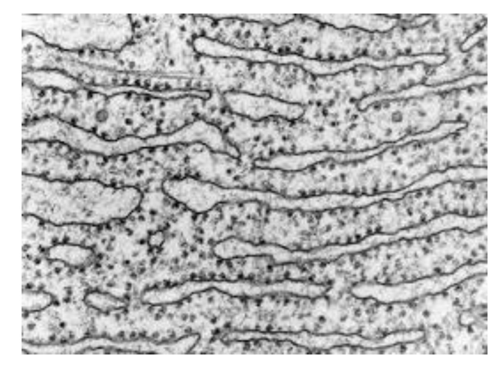 <p>RER - Rough Endoplasmic Reticulum</p>