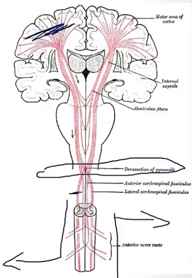 <p>-medulla</p><p>-contralateral; ipsilateral</p>