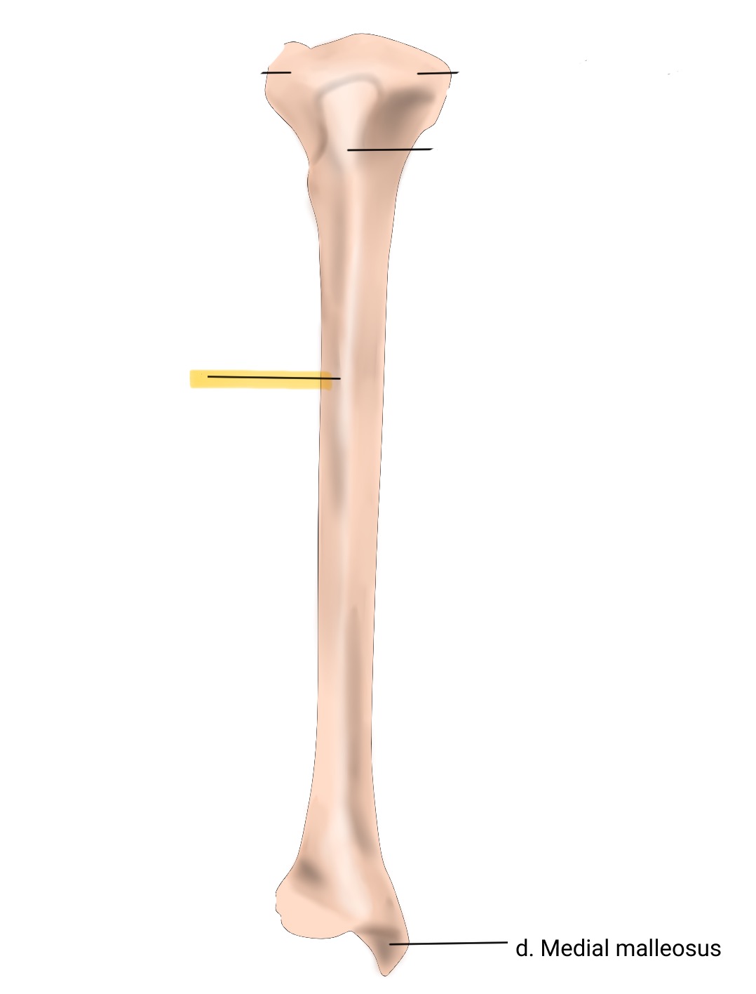 <p>The sharp edge along the anterior aspect of the tibia, providing attachment for muscles and enhancing stability. </p>
