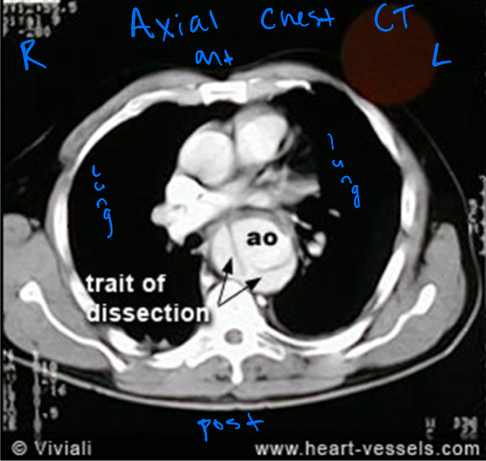 <p>Many- used extensively for chest, abdominal, neurological, and musculoskeletal disease </p><p>Chest CT</p><p>—for evaluation or detection of lung cancer, pathologies of the lung</p><p>—CT guided biopsies of chest lesions are also commonly performed</p>