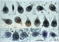 <p>This is the _ stage of Giradia lamblia</p>