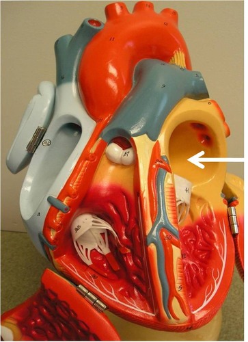 Receives oxygenated blood from the lungs