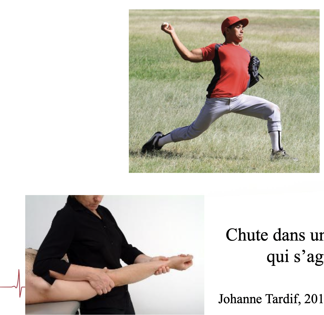 <p>Stress en valgus</p><p>Ex: </p><ul><li><p>Lancer une balle de baseball</p></li><li><p>Chute dans un escalier avec le bras qui s’agrippe à la rampe</p></li></ul><p></p>