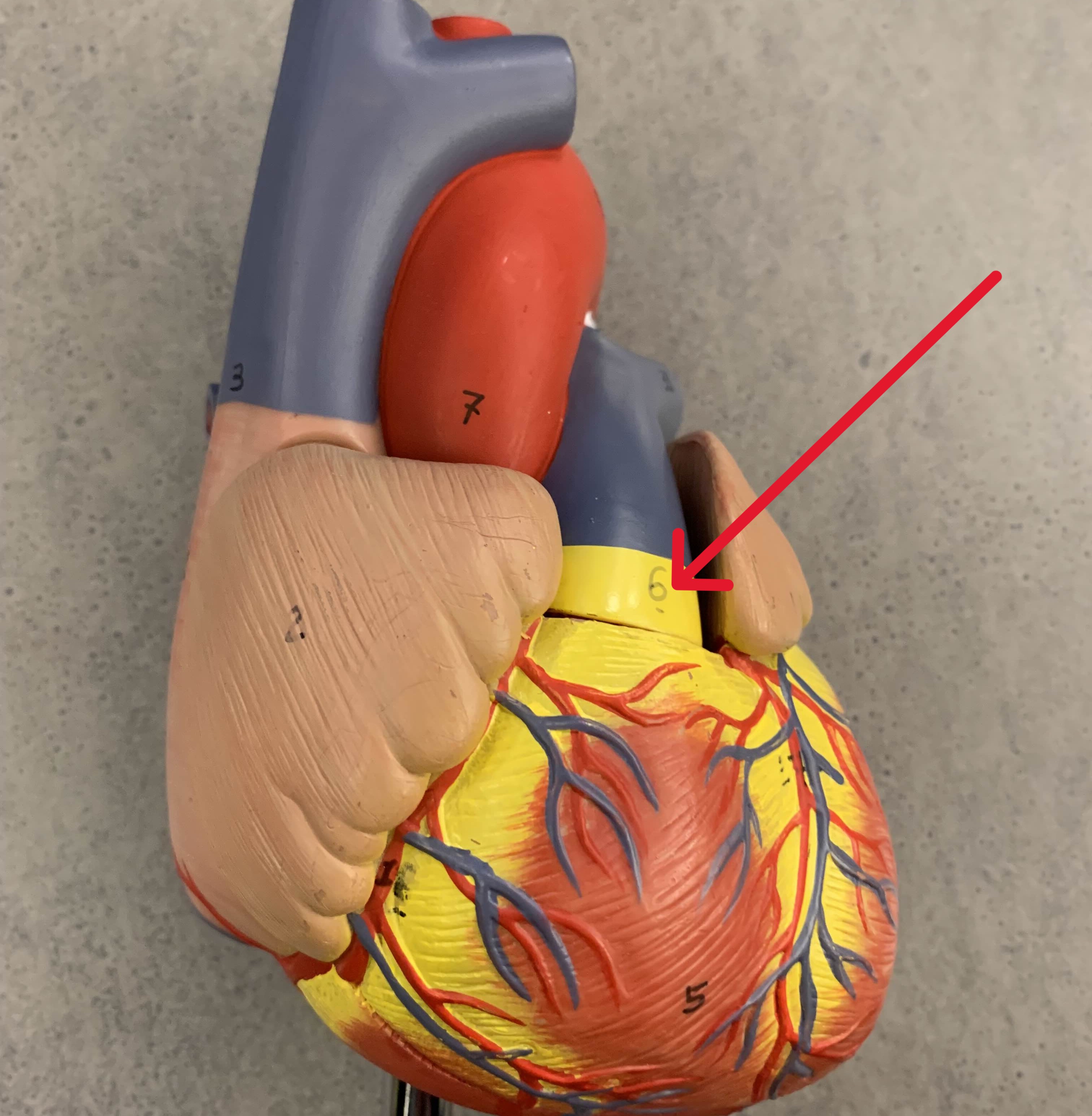 <p>Which vessel of heart:</p><ul><li><p>Blood enters from right ventricle</p></li></ul><p></p>