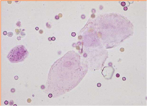 <p>These cells are present on sediment evaluation. What are they?</p>
