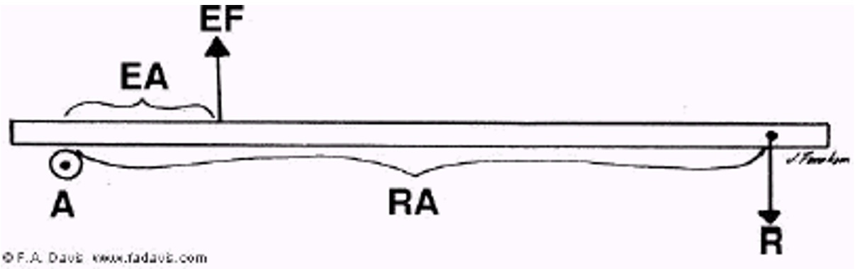 <p>What kind of lever is depicted?</p>
