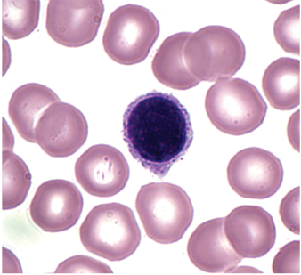 <p>Lymphocyte</p>