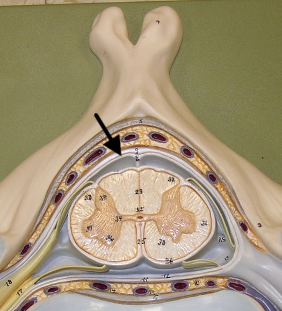 <p>middle layer of the meninges. Subarachnoid space CSF</p>