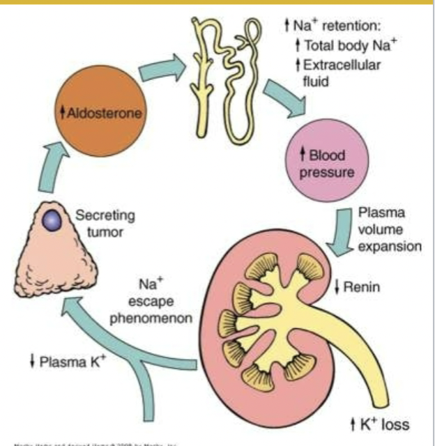 primary hyperaldosteronism