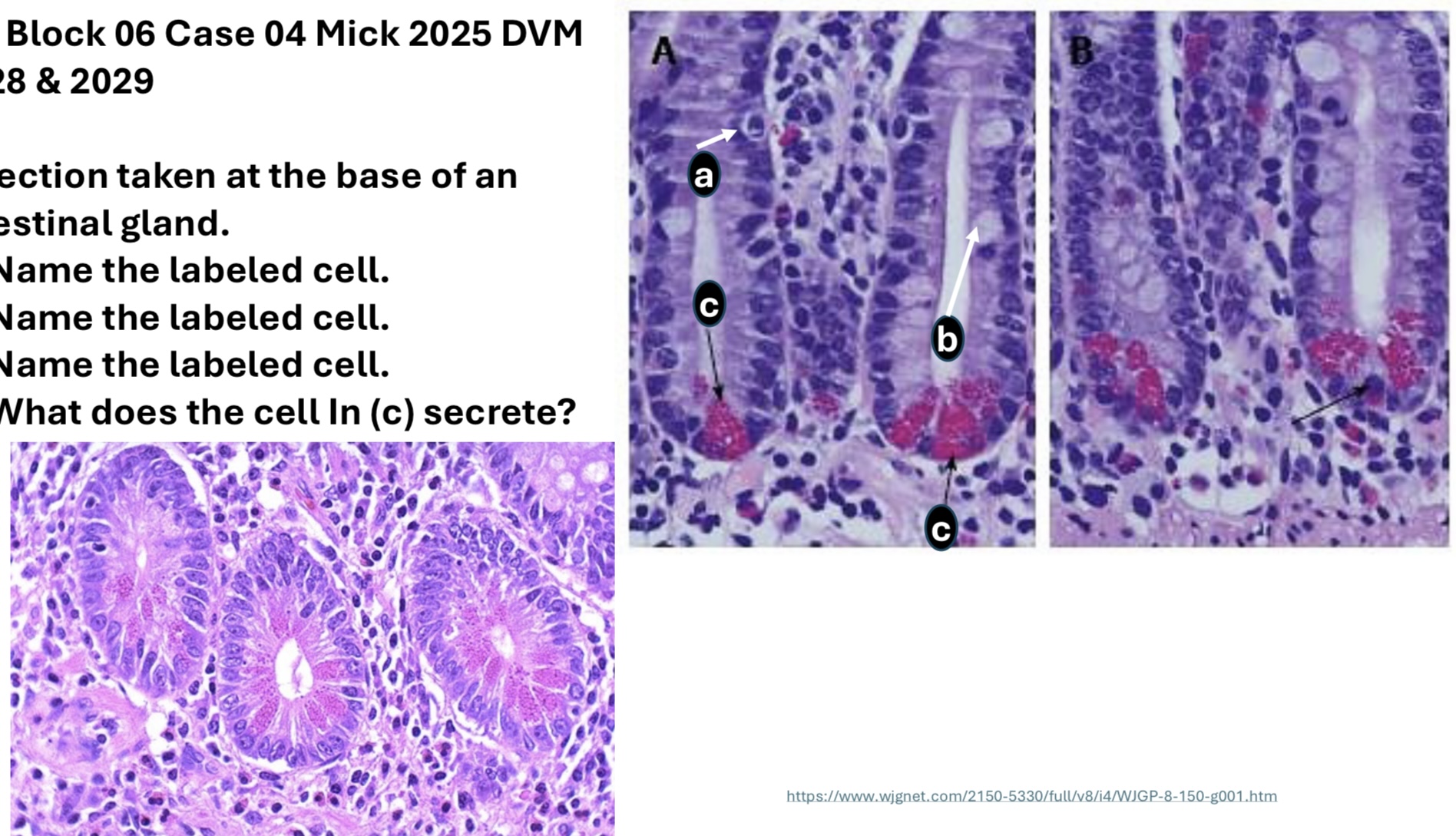 <p>A section taken at the base of an intestinal gland. </p><p>A. Name the labeled cell </p><p>B. Name the labeled cell</p><p>C. Name the labeled cell</p><p>D. What does the cell in (C) secrete? </p>