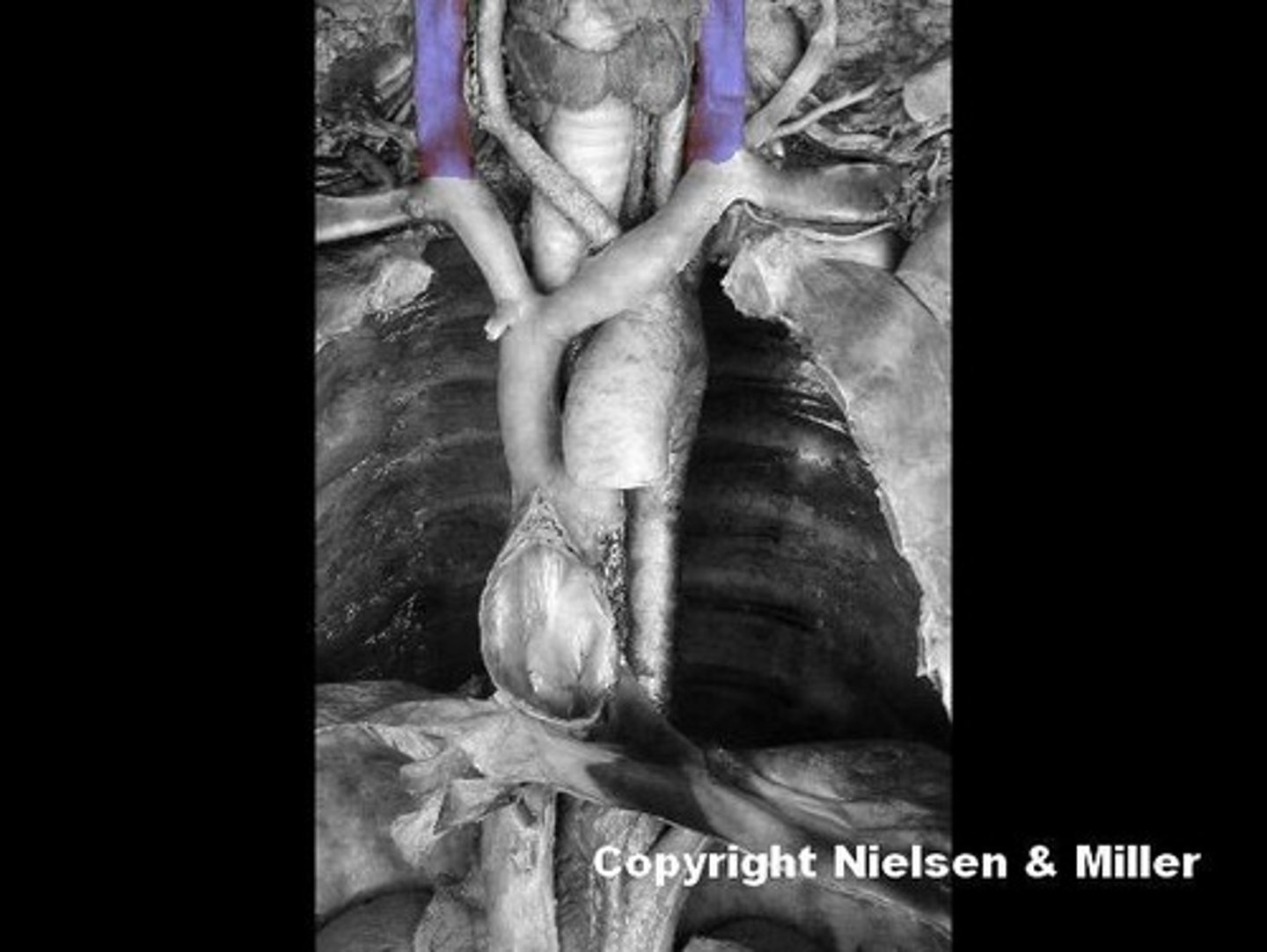 <p>Identify the highlighted vessels.</p>