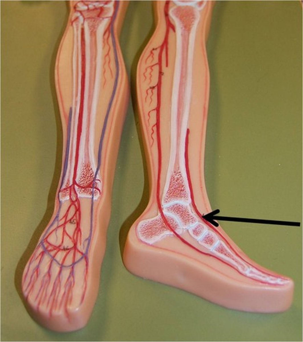 <p>Name the blood vessel.</p>