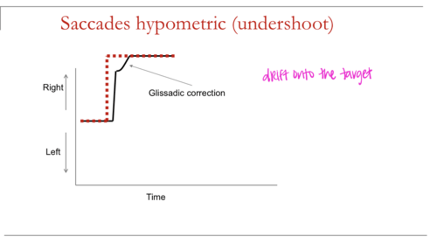 <p>Saccades HYPOMETRIC Undershoot (Pic)</p>
