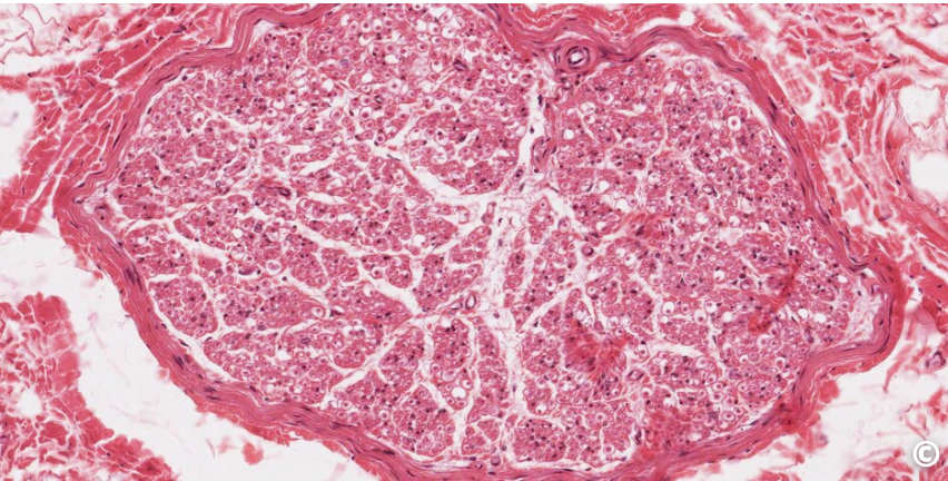 <p>what type of neural tissue is this</p>