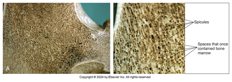<p>Bone Type Classification: Cancellous Bone</p>