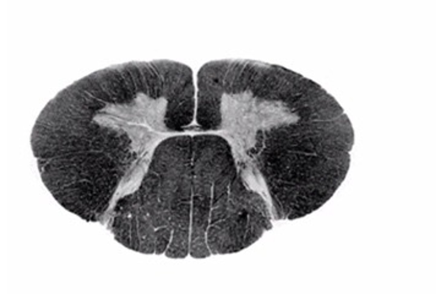 <p>Identify the spinal cord level</p>