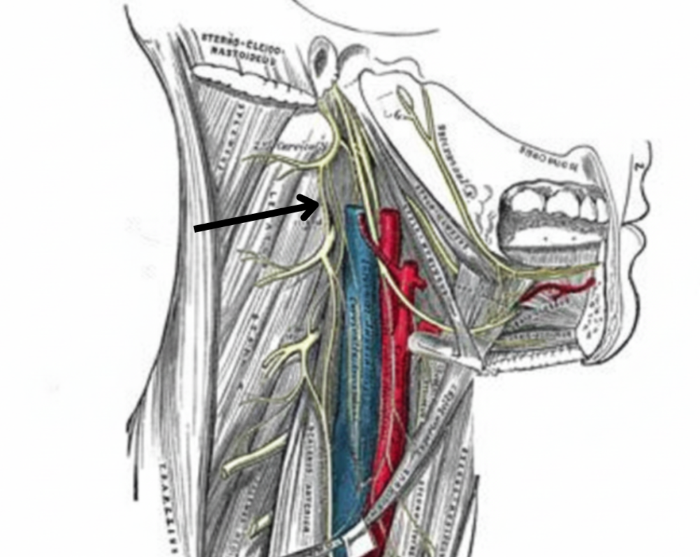 term image