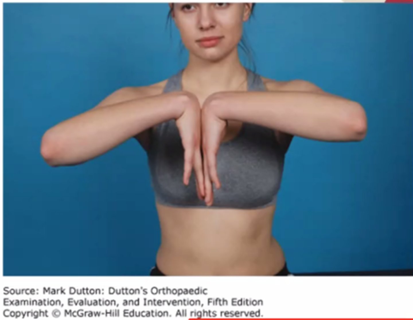 <p>D. Median nerve at the carpal tunnel</p>