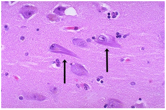 term image