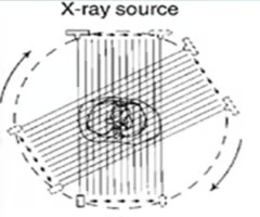 <p>1st generation (parallel beam)</p>
