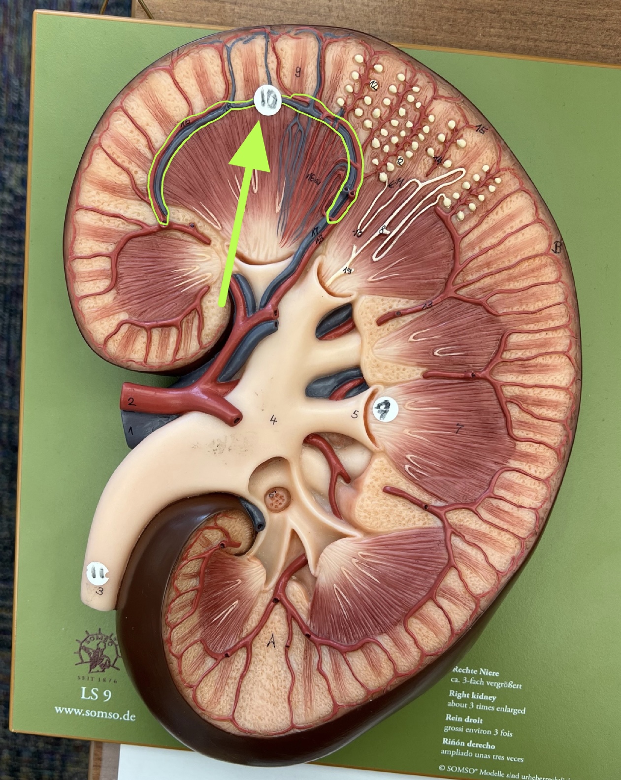 the vessel indicated next carries blood into the ________