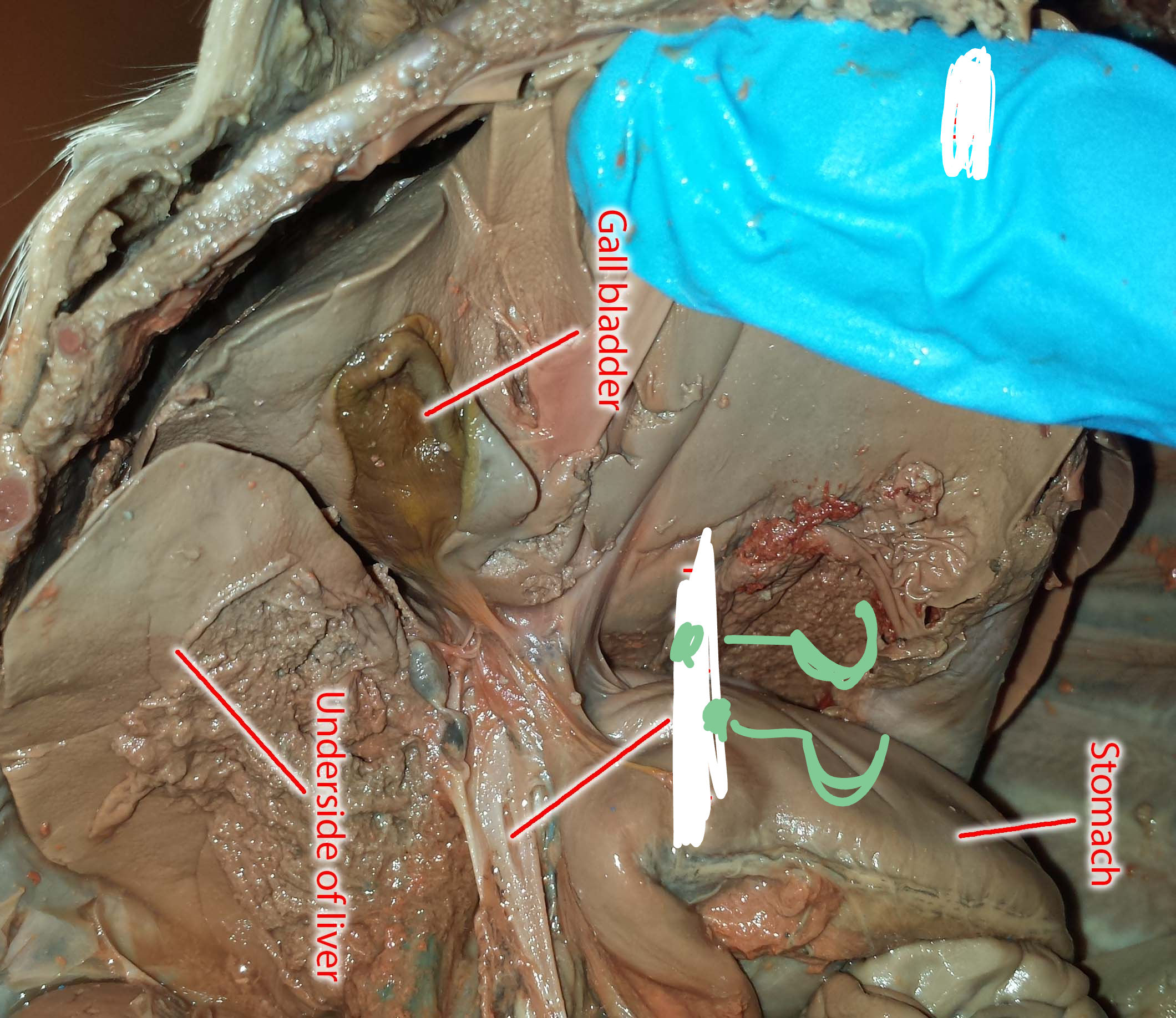 <p>Opening in liver that allows blood vessels and other structures to enter and leave liver</p>