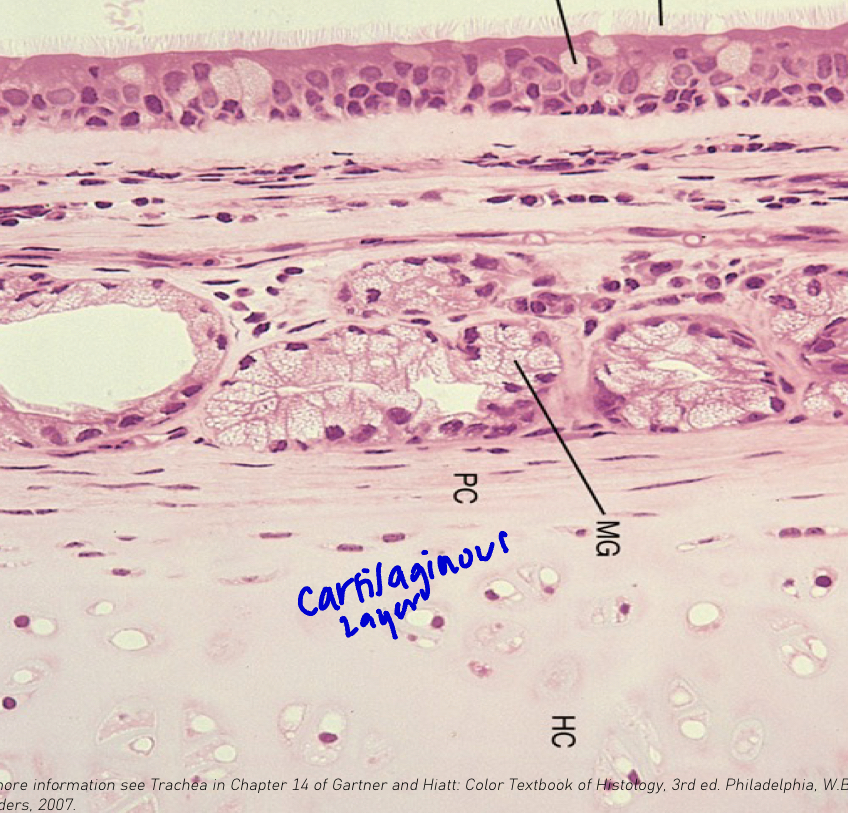 <p><strong><u>Shape of cartilage rings:</u> </strong><span style="color: blue"><strong>C shape</strong></span></p><p><strong><u>Composition:</u> </strong><span style="color: blue"><strong>Chondrocytes</strong></span><strong> </strong>in <span style="color: blue"><strong>lacunae</strong></span><strong> </strong></p><p><strong><u>Describe perichondrium:</u> </strong><span style="color: blue"><strong>Dense connective tissue</strong></span><strong> </strong>surrounding the <span style="color: blue"><strong>cartilage</strong></span><strong> </strong></p><p></p>