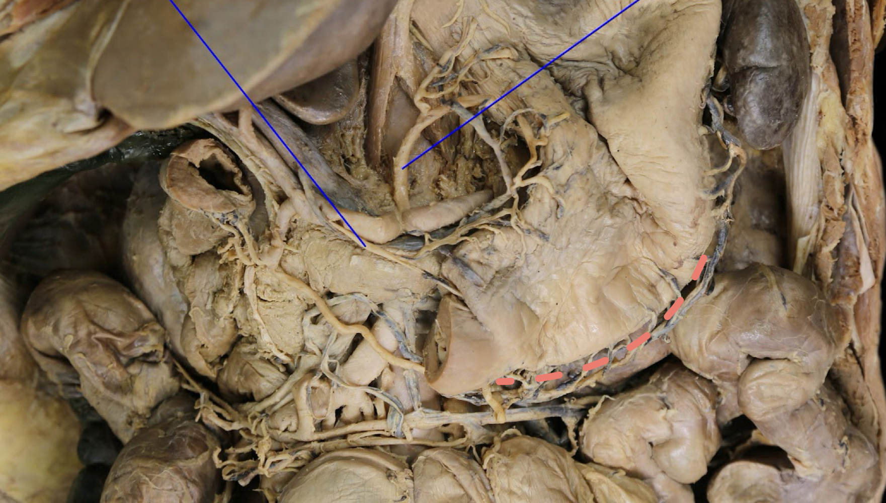 <p>A). Identify this structure<br>B). What supplies blood to this structure?</p>