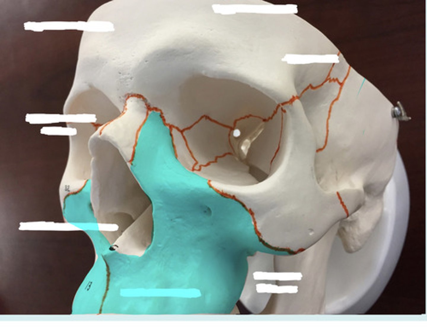 <p>What bone is highlighted here?</p>