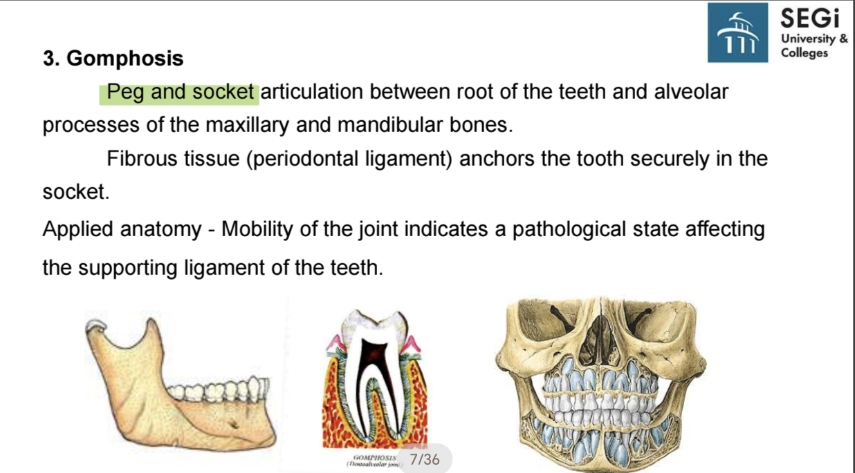 <p class="has-focus">Immovable (synarthrodial) joints (fibrous joint) 3. Gomphosis</p><p>A peg and socket articulation between the root of the teeth and the alveolar processes of the jaw.</p>