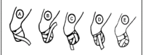 <p>use this for  for anchoring a dressing on fingers, the head, or on a stump</p>