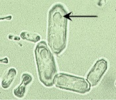 <p>What crystal is this?</p>