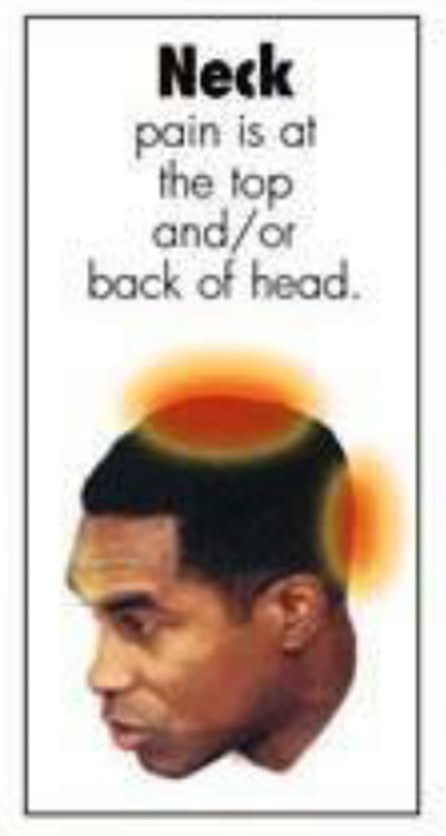<p>Pain is at the top and/or back of head</p>