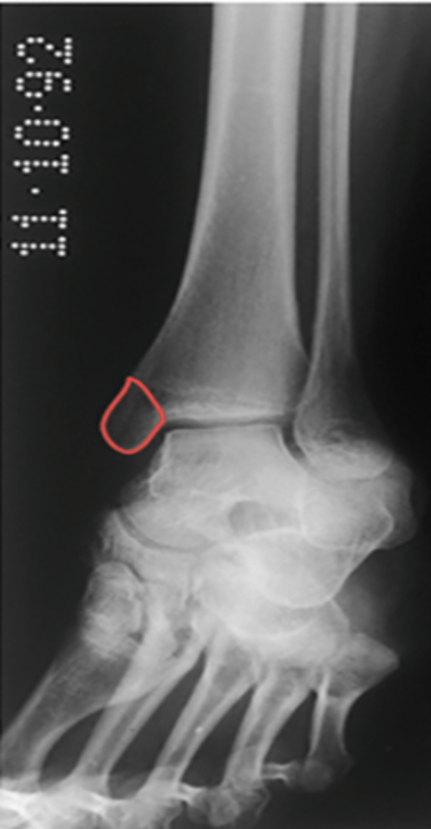 <p>What structure is highlighted?</p>